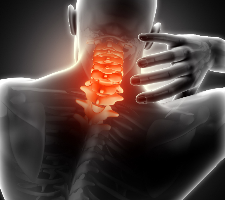 Hvad er piskesmæld, hvad kan der gøres og hvordan vil Stevns Kiropraktor løse problemet.